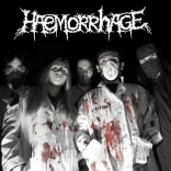 haemorrhage